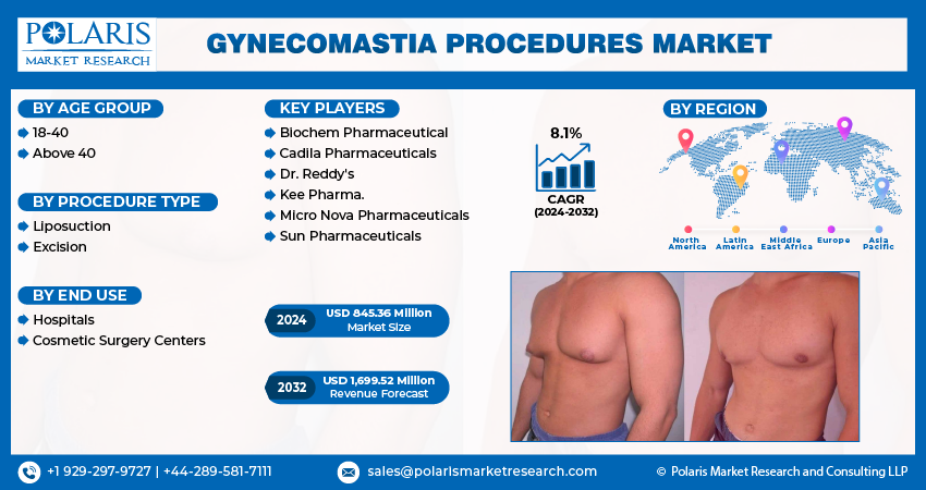  Gynecomastia Procedures